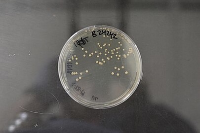 Microbacteriaceae
