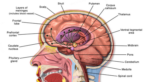 Alcohol-related dementia