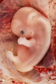 Embryo cryopreservation
