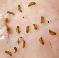 Embryo